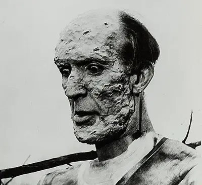 Frank Douglas