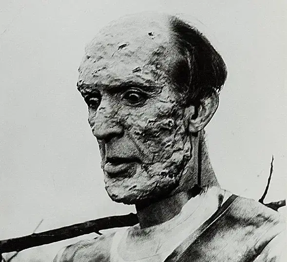 Frank Douglas