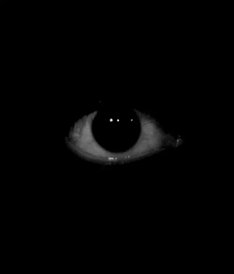 Eye